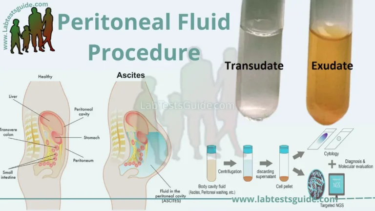 Peritoneal Fluid Test Procedure