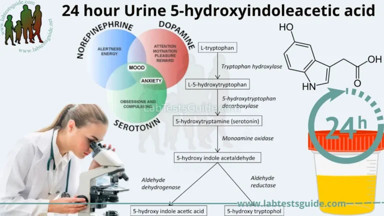 24 hour Urine 5-hydroxyindoleacetic acid