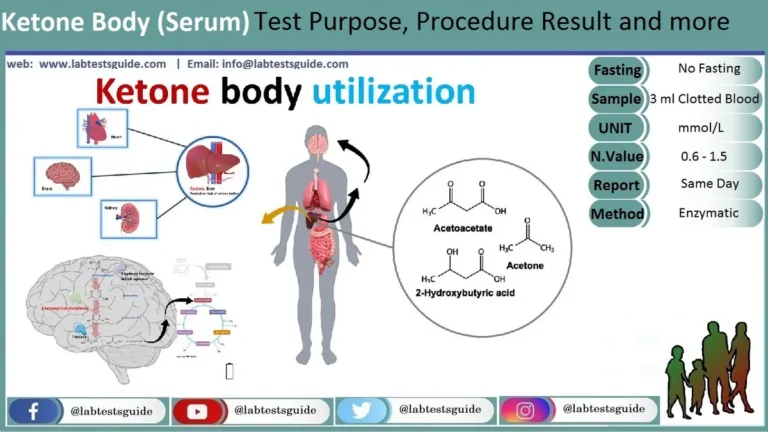 Acetoacetic Acid Test