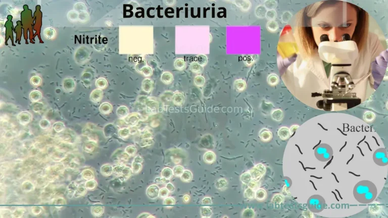 Bacteriuria
