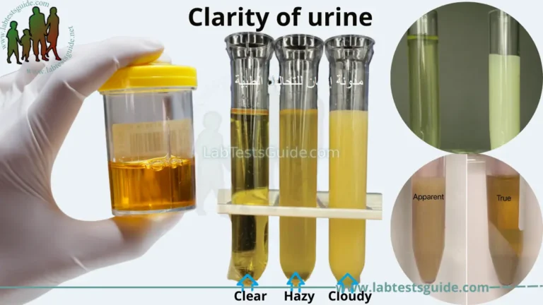 Urine Appearance