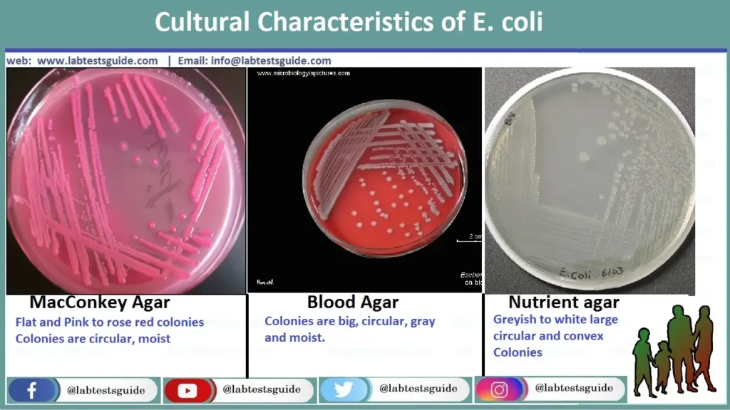 Cultural Characteristics of E.coli