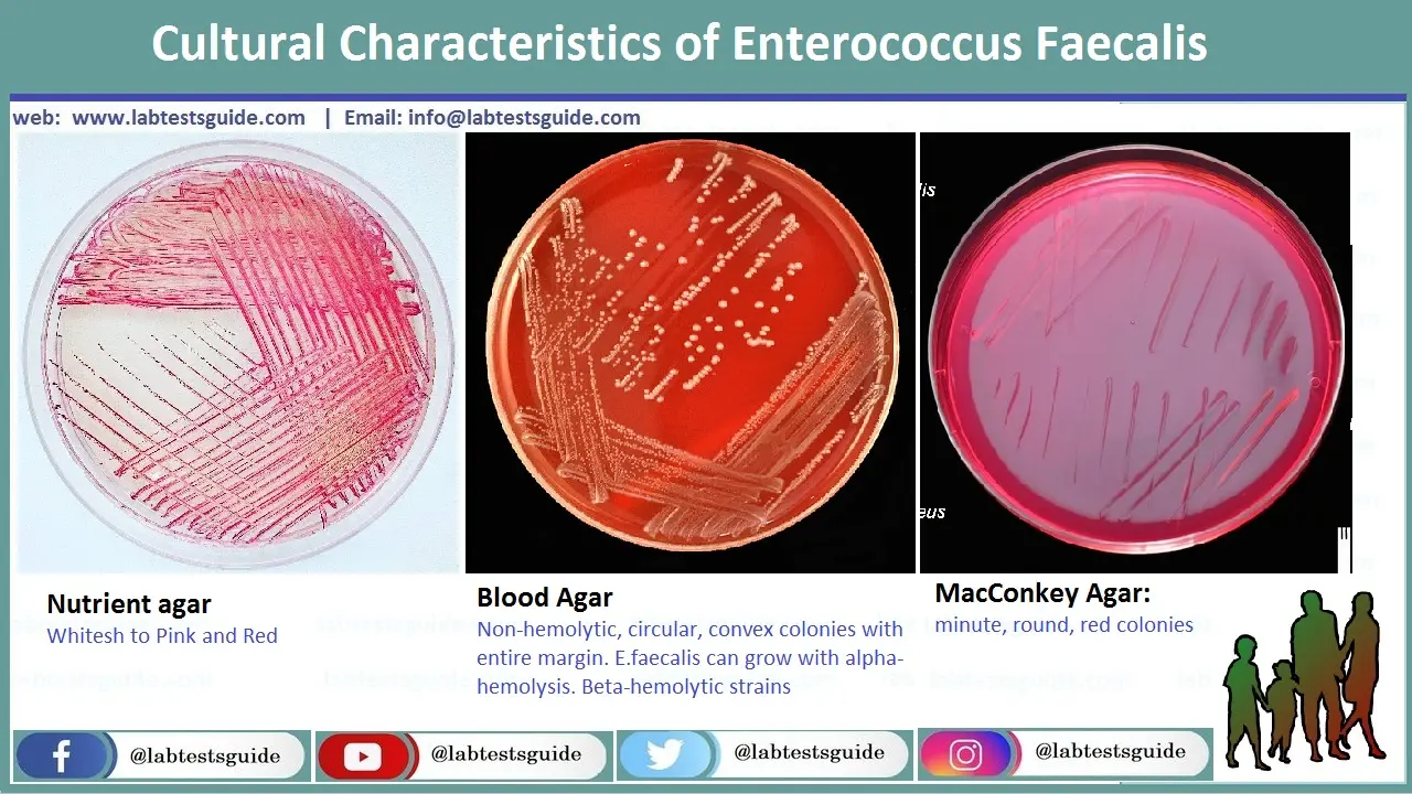 Enterococcus Faecalis in unire culture