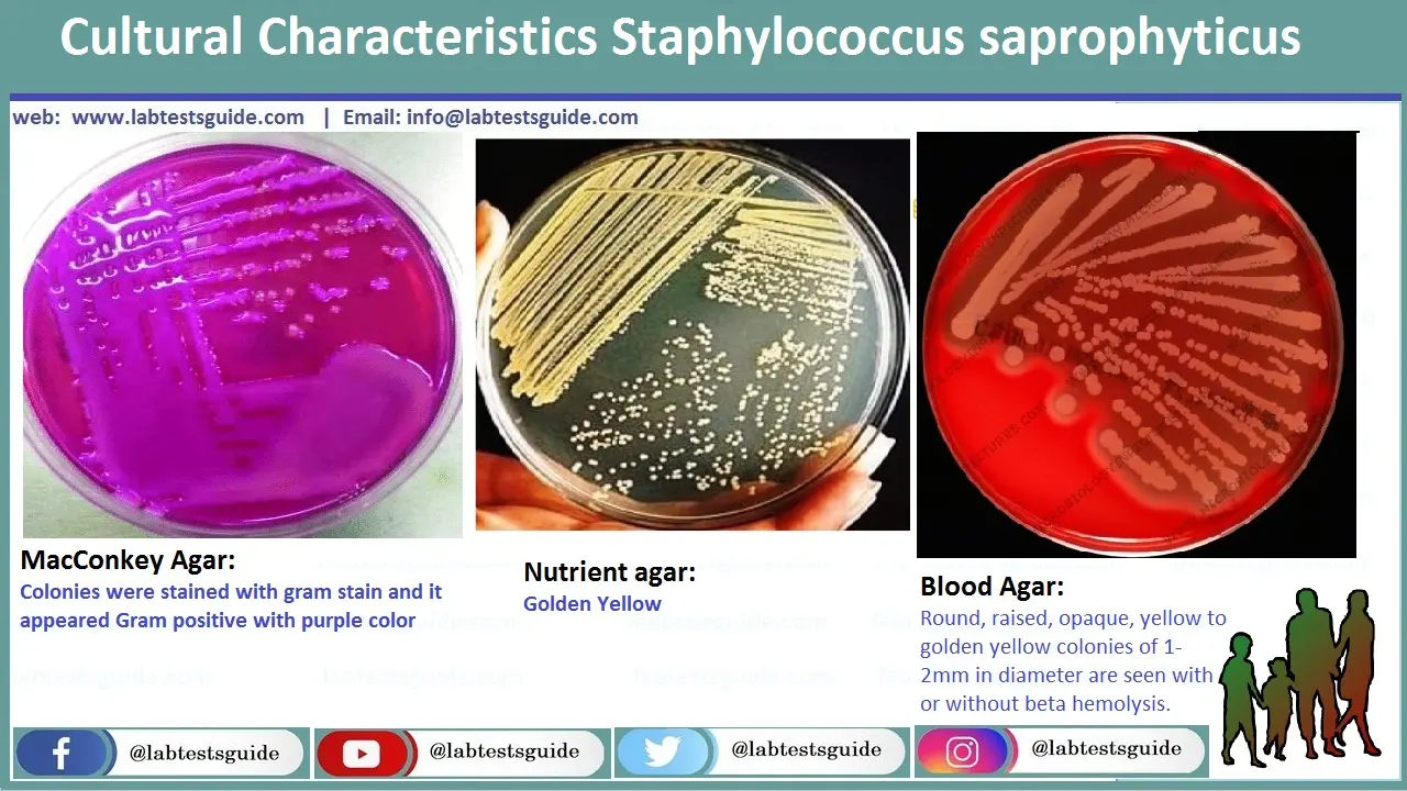 Staphylococcus Saprophyticus in unire culture