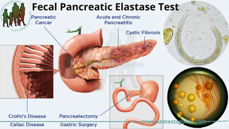 Fecal Pancreatic Elastase Test