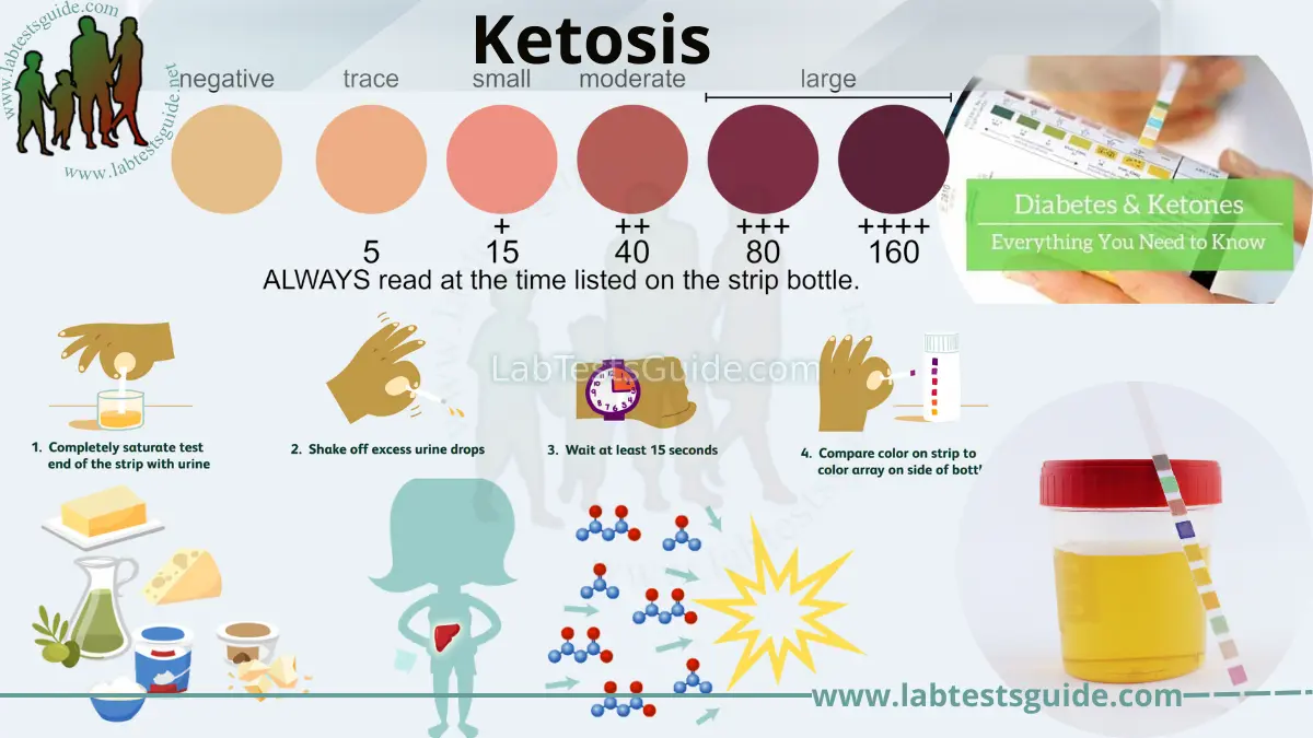 Keto Testing: A Guide to Testing Your Ketones & Glucose Levels