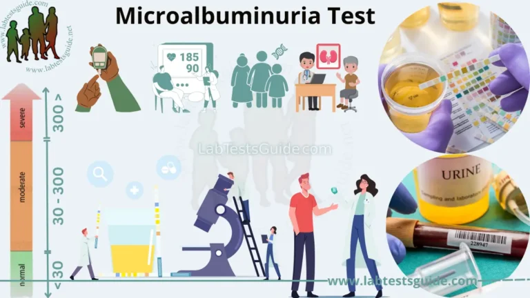 Microalbuminuria Test