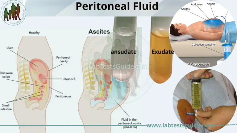 Peritoneal Fluid