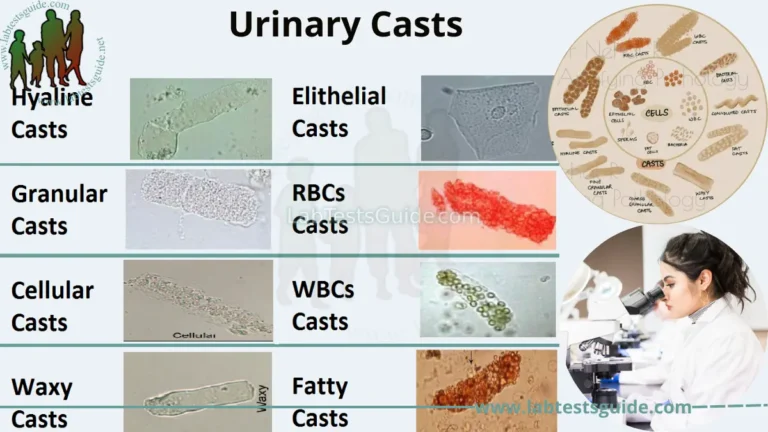Urinary Casts