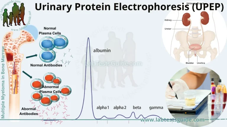 Urinary Protein Electrophoresis