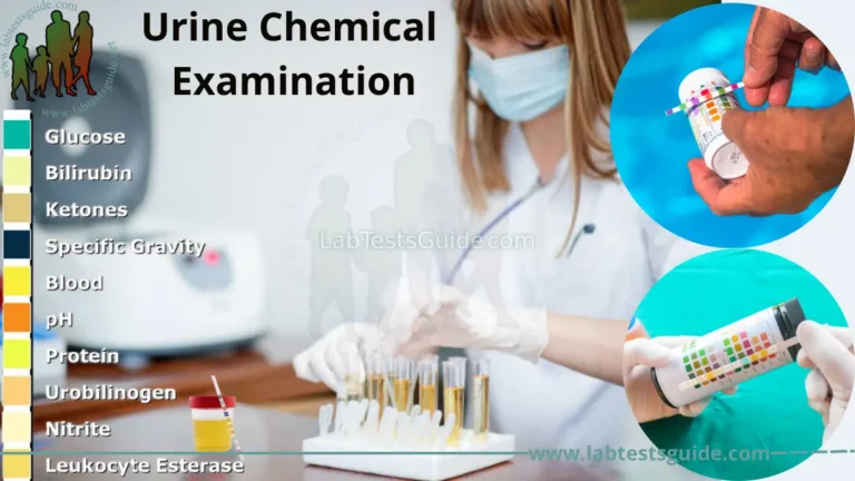 Urine Chemical Examination