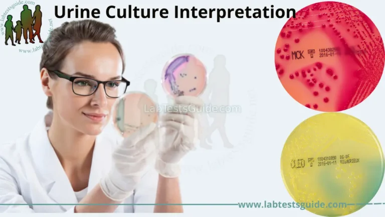 Urine Culture Interpretation