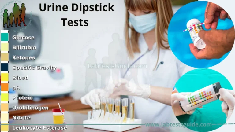 Urine Dipstick Tests
