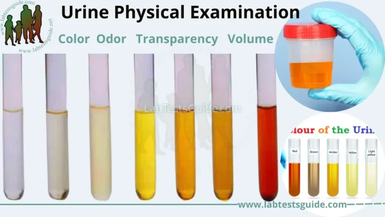 Urine Physical Properties