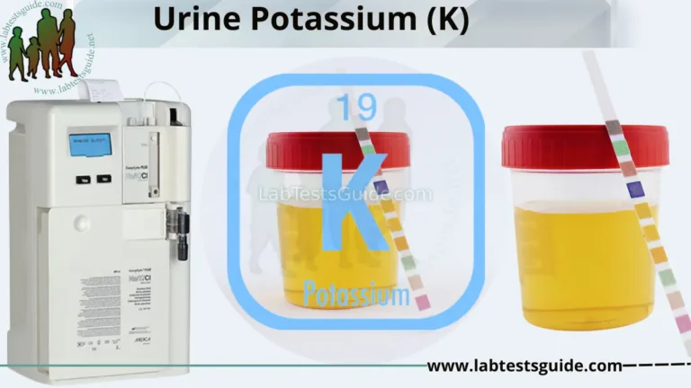 Urine Potassium (K)