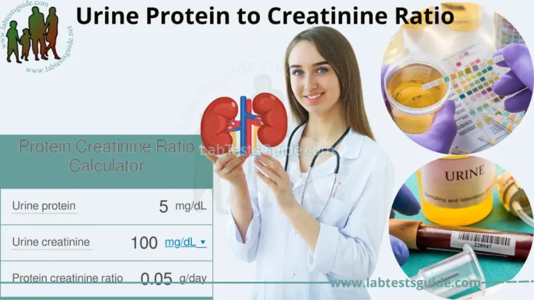 Urine Protein to Creatinine Ratio