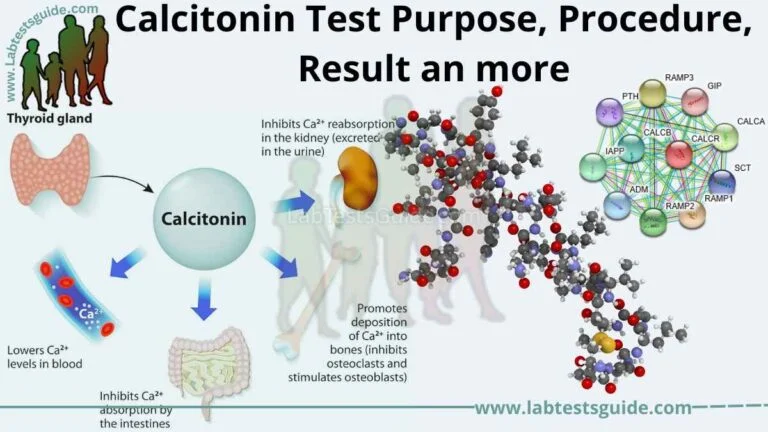 Calcitonin Test Purpose, Procedure, Result an more