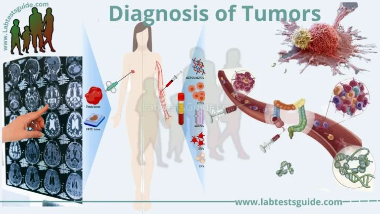 Diagnosis of Tumors