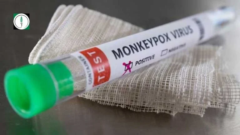 Monkeypox in Pakistan
