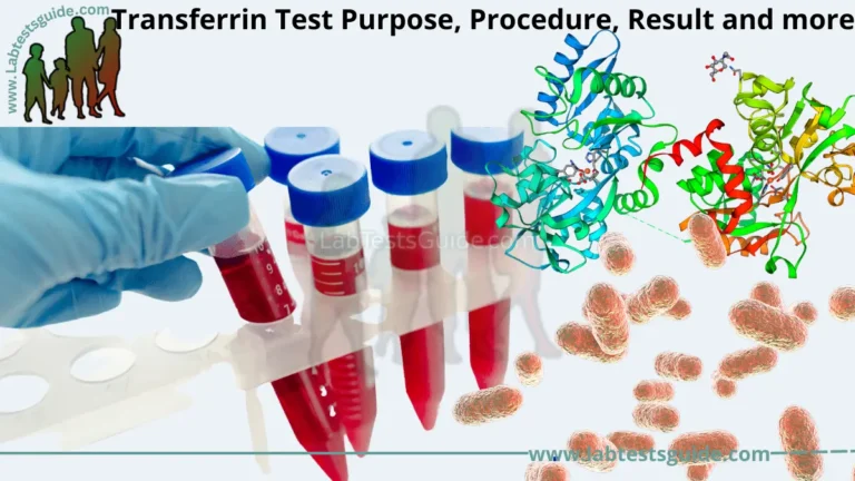Transferrin test