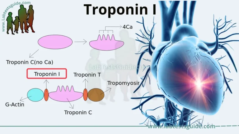 Troponin I