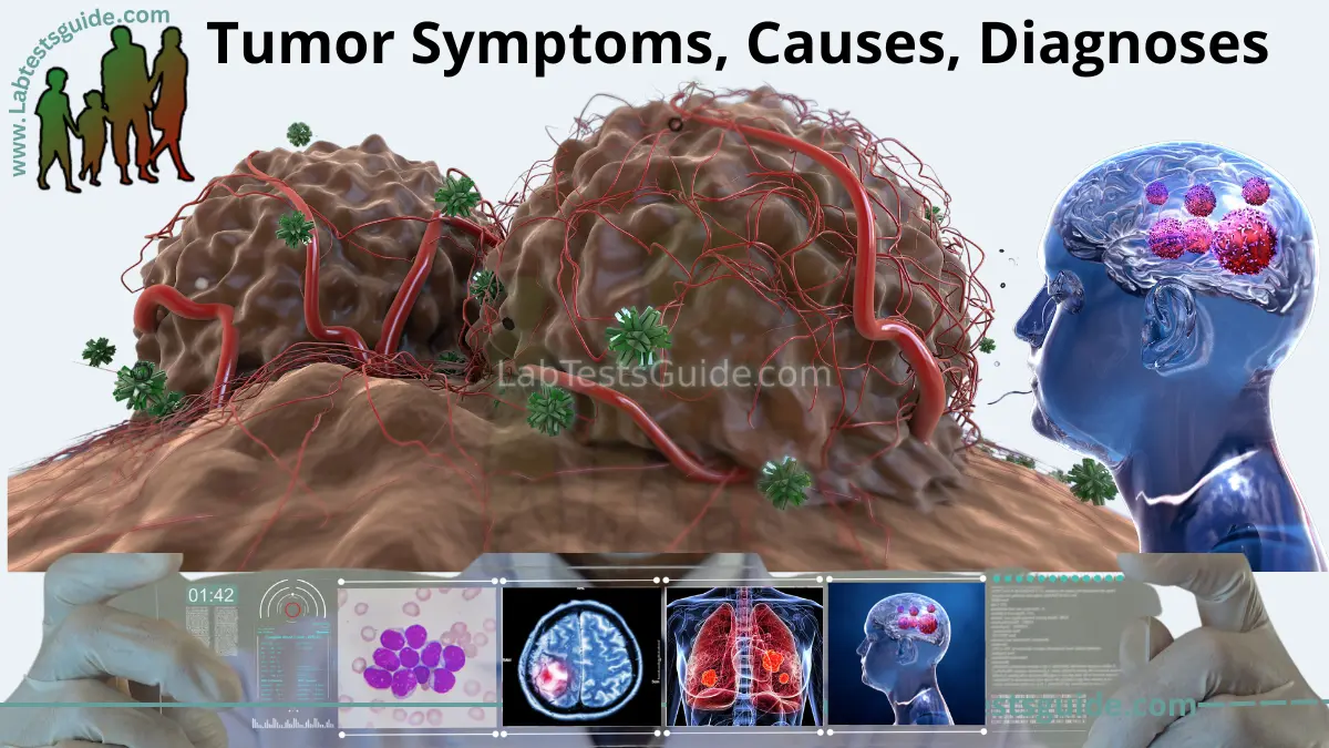 Exploded Tumor Tumor Symptoms, Diagnoses, Treatment etc | Lab Tests Guide