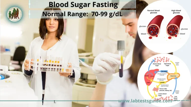 Blood Sugar Fasting Test