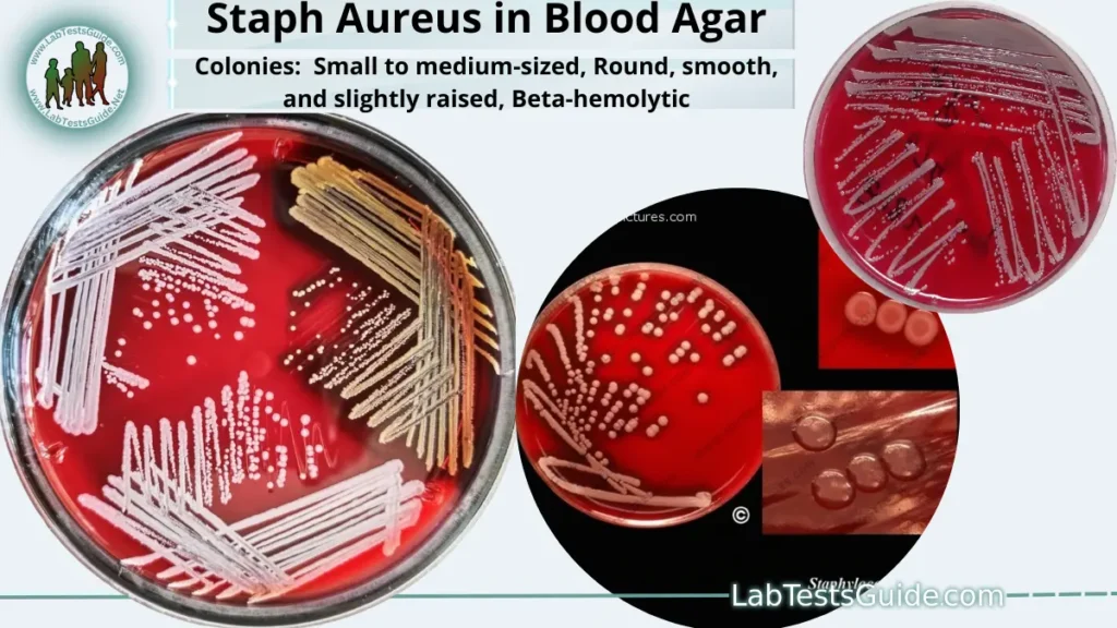 Staphylococcus Aureus Staphylococcus Aureus in Blood Agar