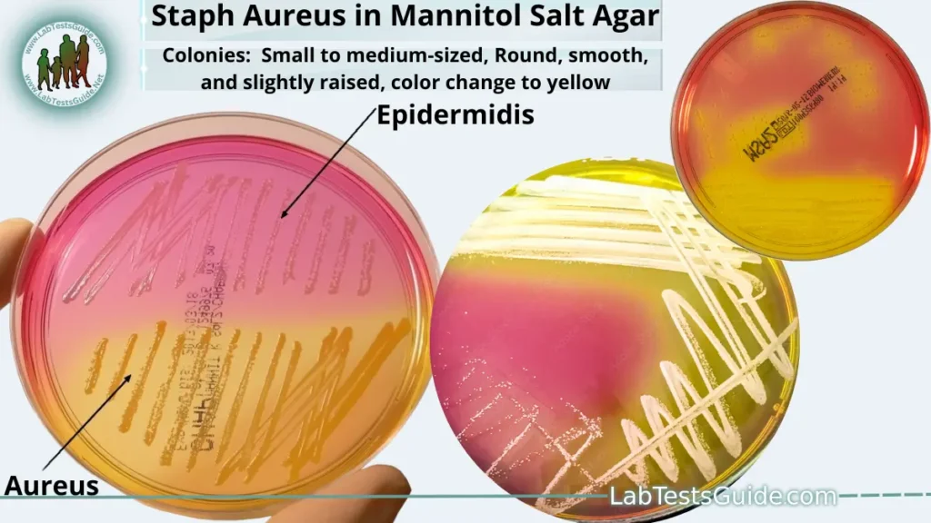 Staphylococcus Aureus Staphylococcus Aureus in Mannitol Salt Agar