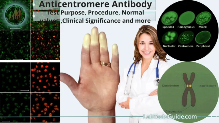 Anticentromere Antibody