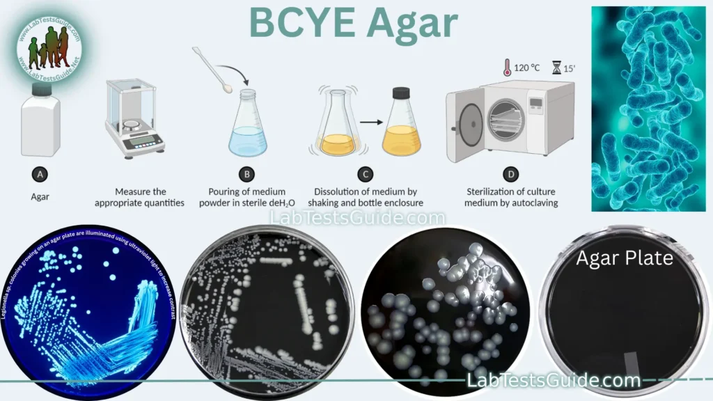 BCYE Agar (Buffered Charcoal Yeast Extract Agar) BCYE Agar (Buffered Charcoal Yeast Extract Agar)