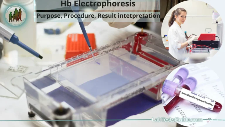 Hb Electrophoresis