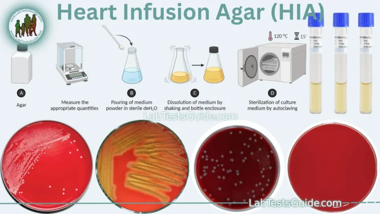 Heart Infusion Agar (HIA)