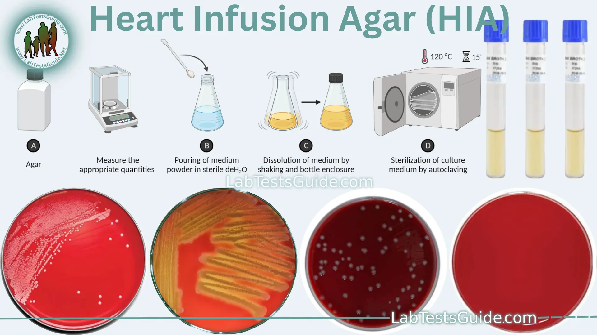 Heart Infusion Agar (HIA) Purpose, Principles, Procedure, Results and more