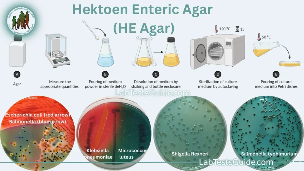 Hektoen Enteric Agar (HE Agar) Hektoen Enteric Agar (HE Agar)