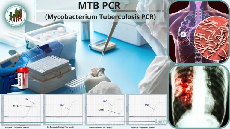 MTB PCR (Mycobacterium Tuberculosis Polymerase Chain Reaction)