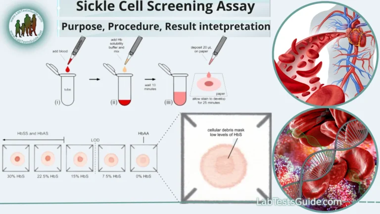 Sickle Cell Screening Assay