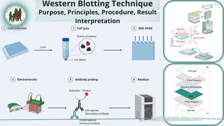 Western Blotting (Immunoblotting)
