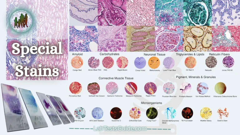 Special Stains A Guide for Histopathologists & Histotechnologists