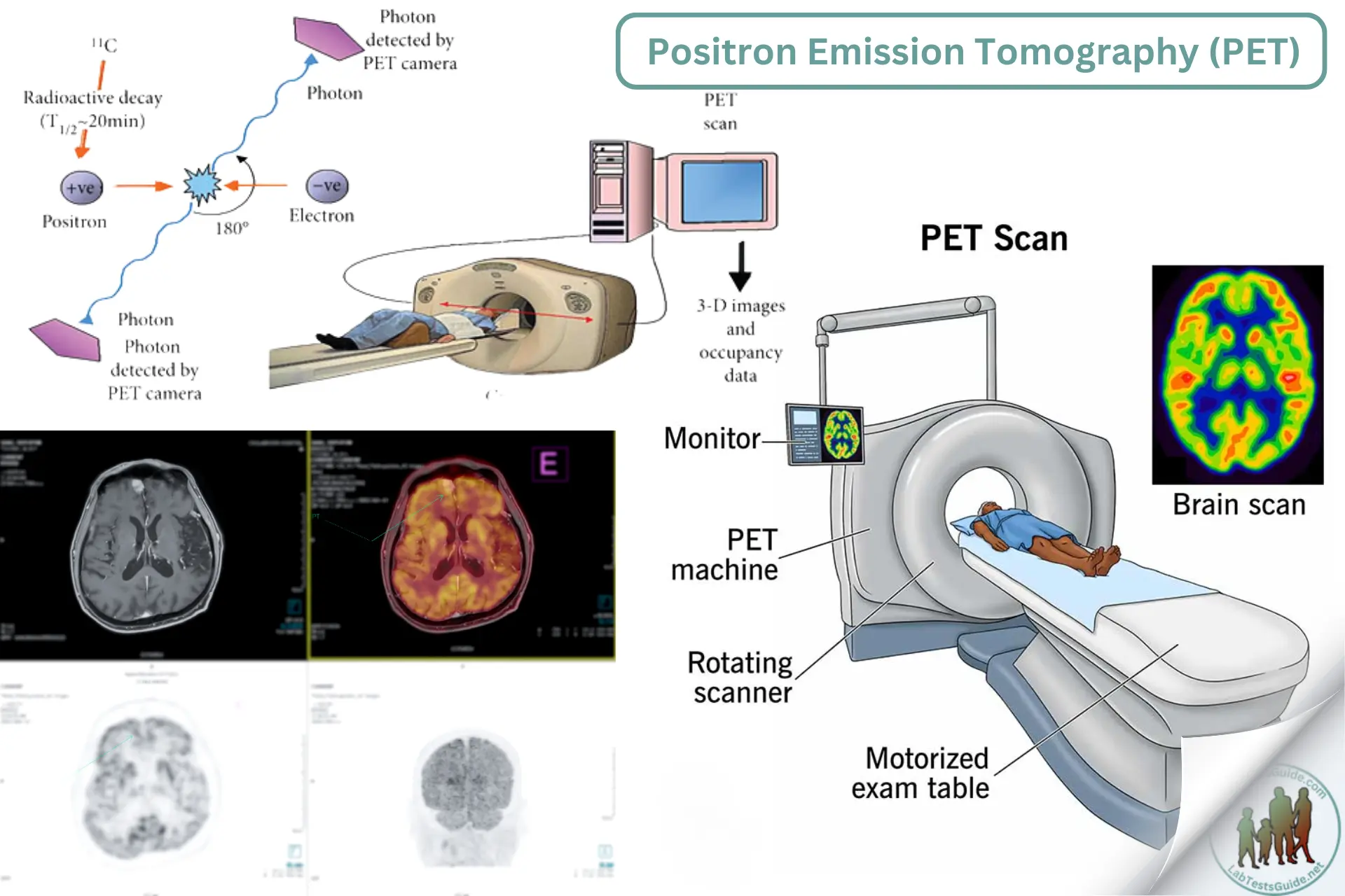 Positron Emission Tomography PET Principle Purpose Requirements Positron Emission Tomography PET Principle Purpose Requirements