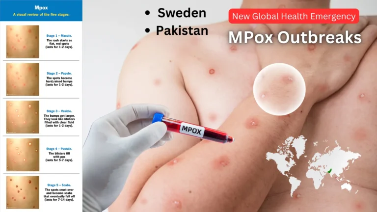A New Global Health Emergency What is Mpox, Where are the Outbreaks, and Will the Virus Spread