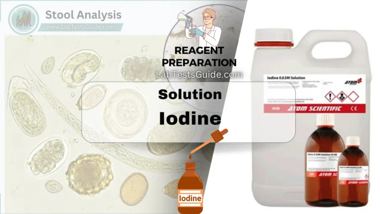 Iodine Iodine Reagent Principle, Composition, Preparation, Method, Precaution and Uses