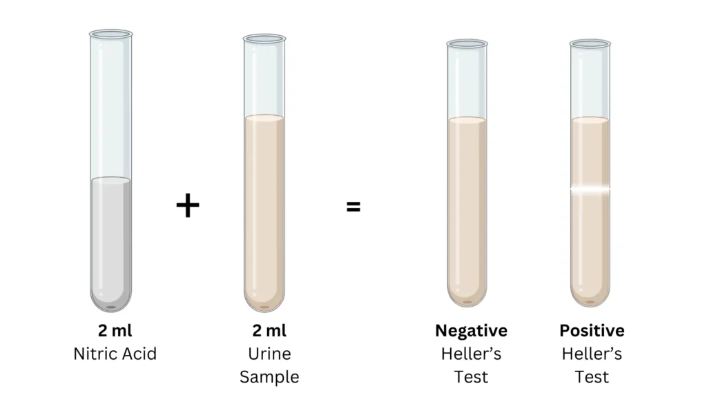 Heller's Test Heller's Test Procedure