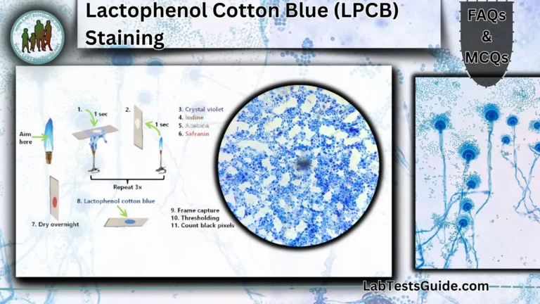 Lactophenol Cotton Blue (LPCB) Staining FAQs and MCQs