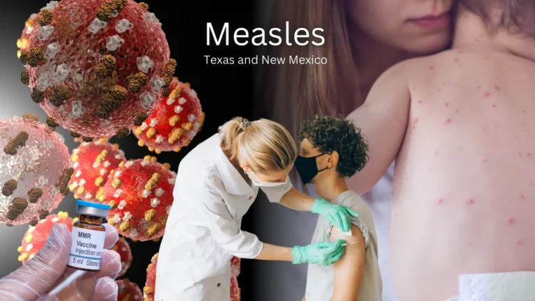 Measles Outbreak in Texas and New Mexico Surpasses 300 Cases, Highlighting Vaccination Gaps
