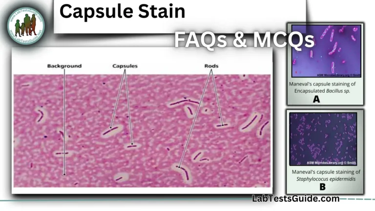 Capsule Stain FAQs and MCQs