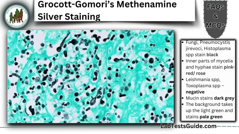 Grocott-Gomori’s Methenamine Silver Staining FAQs and MCQs