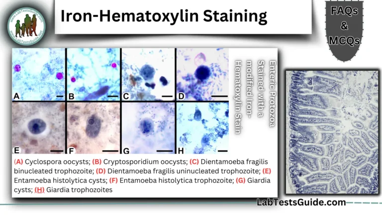 Iron-Hematoxylin Staining FAQs and MCQS