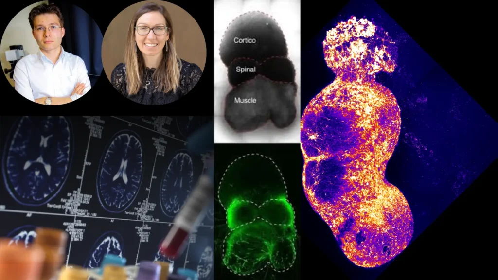 Stanford Scientists Recreate Human Pain Pathway in a Dish, Paving the Way for Better Treatments Stanford Scientists Recreate Human Pain Pathway in a Dish, Paving the Way for Better Treatments