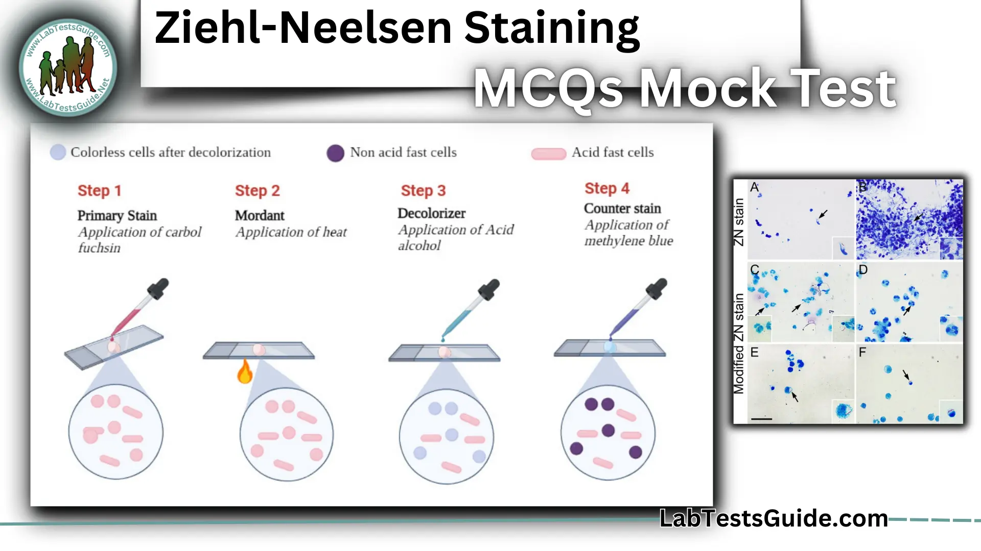 Ziehl-Neelsen Staining MCQs Mock Test